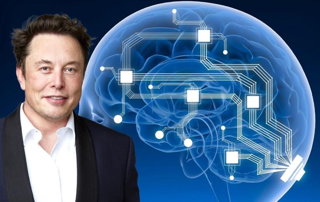 Neuralink